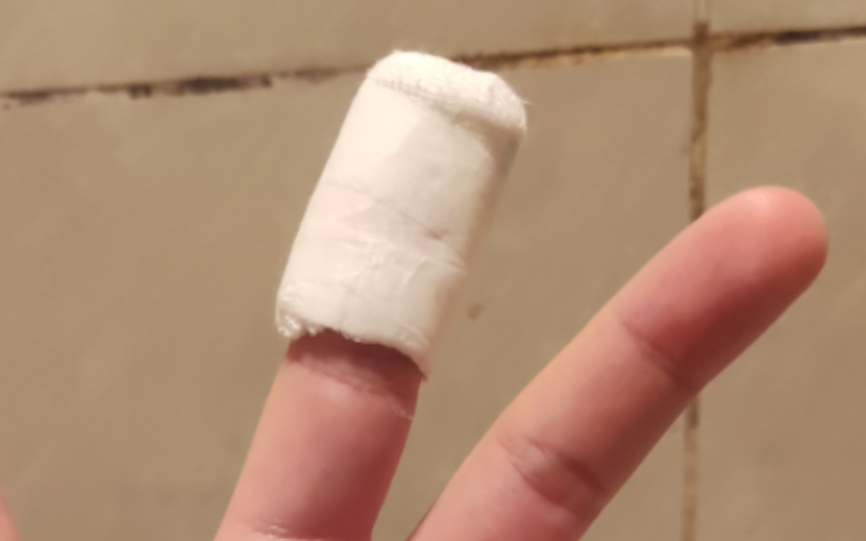 消逝的光芒纱布和酒精在哪 剖宫产后伤口如何护理