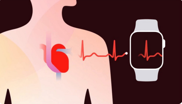Apple Watch心电图大陆地区能用吗