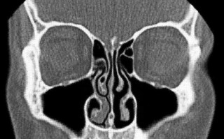 什么？两个鼻孔竟然不能同时呼吸？
