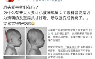 为什么老人总喜欢给孩子睡"扁头"？原来这些年都做错了