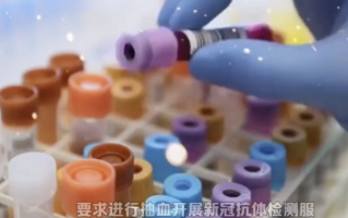 新冠抗体检测有必要吗？专家回应 对疫苗接种有一定参考意义