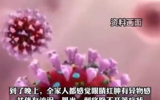 警惕！女子用紫外线灯消毒灼伤全家眼睛