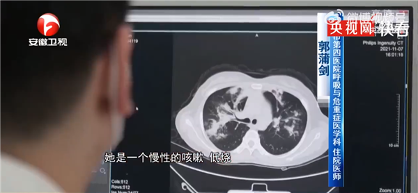 女子接触发霉玉米肺里长黄曲霉菌 没戴口罩防护：医生科普毒性超强-第1张图片-9158手机教程网