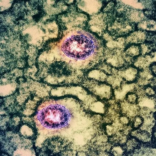 为什么一个病毒株传着传着就没了？-第3张图片-9158手机教程网