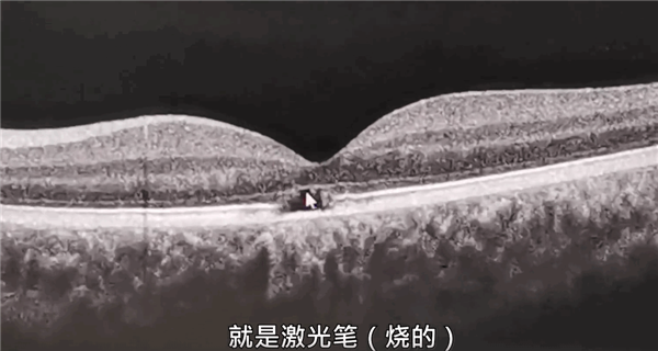 男子开车时被激光笔照射 瞬间眼前一片黑!专家称可能会永久损伤-第3张图片-9158手机教程网 男子开车时被激光笔照射 瞬间眼前一片黑!专家称可能会永久损伤-第3张图片-9158手机教程网