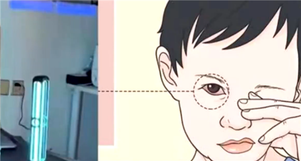 女子在家用紫外线灯消毒患雪盲症 医生:操作需戴防护眼镜-第2张图片-9158手机教程网 女子在家用紫外线灯消毒患雪盲症 医生:操作需戴防护眼镜-第2张图片-9158手机教程网