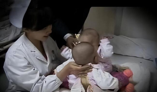 夫妻连生两胎均患怪病性别难辨：彼比相连共用一个排泄系统-第2张图片-9158手机教程网
