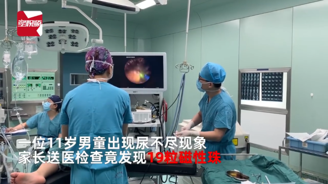 男孩膀胱塞入19粒磁珠1年后取出，都是好奇惹的祸，一直没说告知家长-第1张图片-9158手机教程网