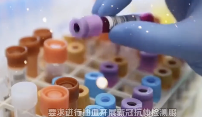 新冠抗体检测有必要吗？专家回应 对疫苗接种有一定参考意义-第1张图片-9158手机教程网