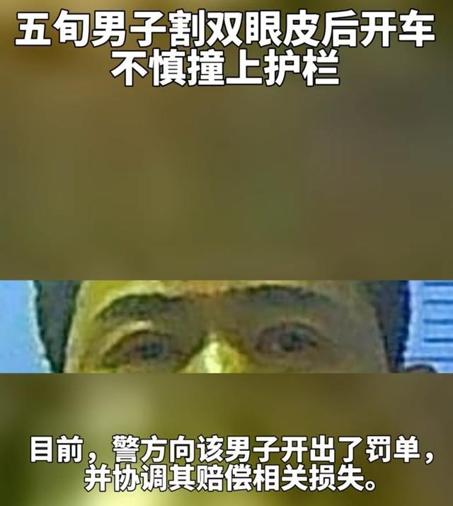 五旬男子因刚割双眼皮开车撞上护栏 都是药膏惹祸-第3张图片-9158手机教程网