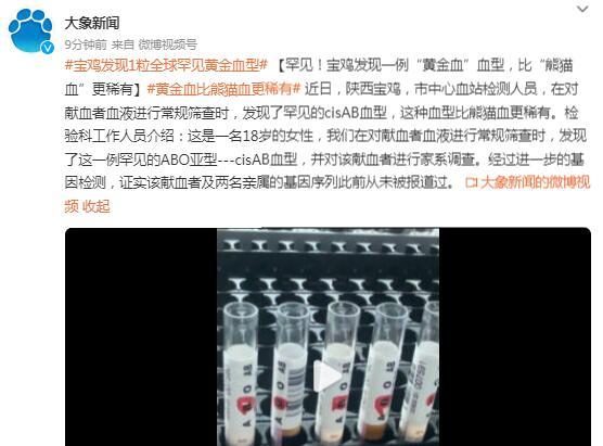 陕西宝鸡发现一例稀有血型 极具科研价值对医疗界有重大意义-第2张图片-9158手机教程网 陕西宝鸡发现一例稀有血型 极具科研价值对医疗界有重大意义-第2张图片-9158手机教程网