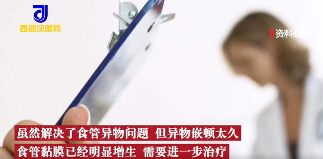 2岁娃咳嗽50天查出硬币卡喉 网友:这家长心真大-第5张图片-9158手机教程网 2岁娃咳嗽50天查出硬币卡喉 网友:这家长心真大-第5张图片-9158手机教程网